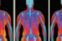 Hologic Advanced Body Composition assessment